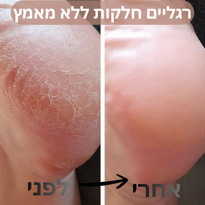 המכשיר שלנו